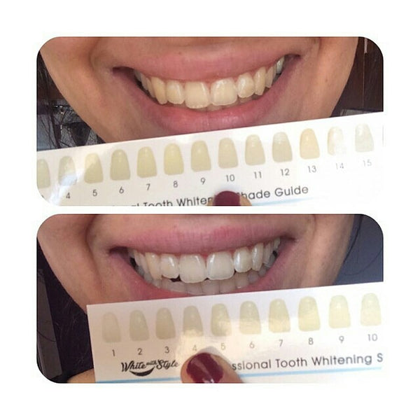 Cyber Deal Three Pack Assorted Teeth Whitening Gel Refills