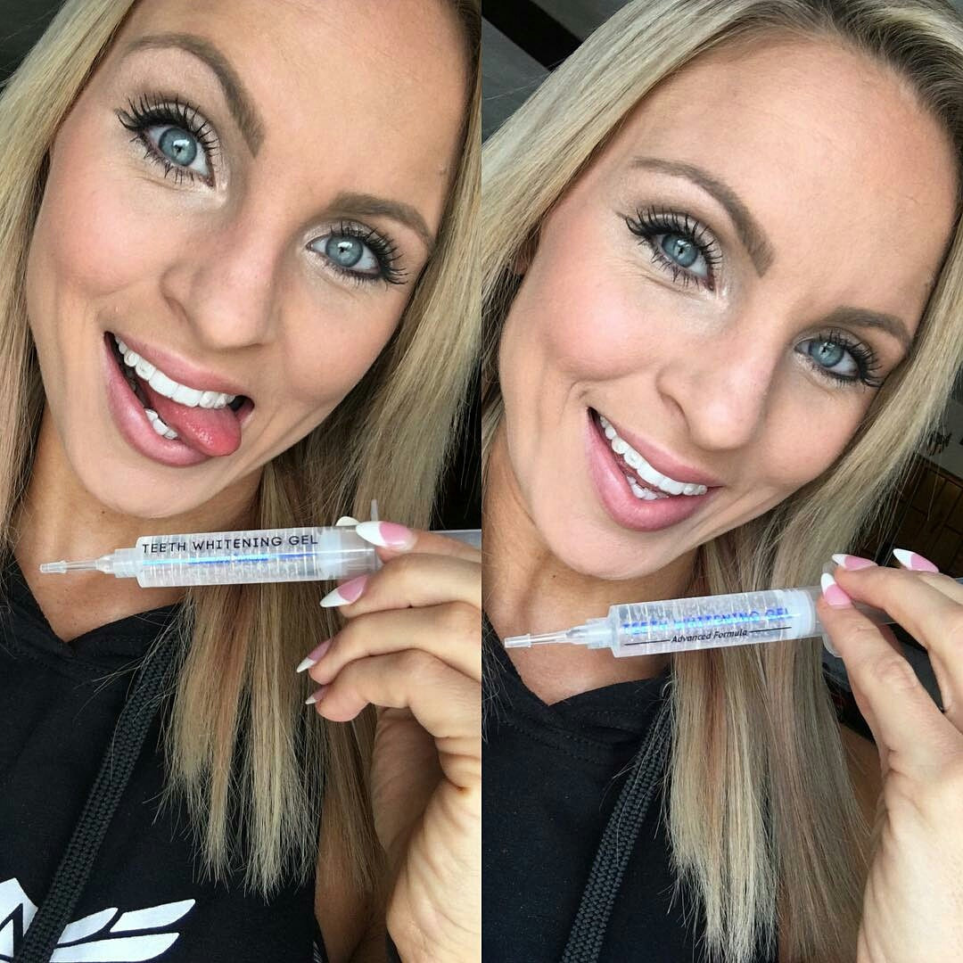 Teeth Whitening Gel – Whitewithstyle